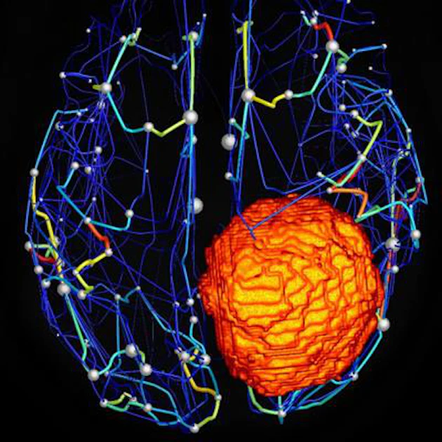 New software creates personalized 'virtual brain' models | AuntMinnieEurope