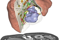 2018 05 30 18 05 5619 2018 05 31 Liver Risk Analysis 400