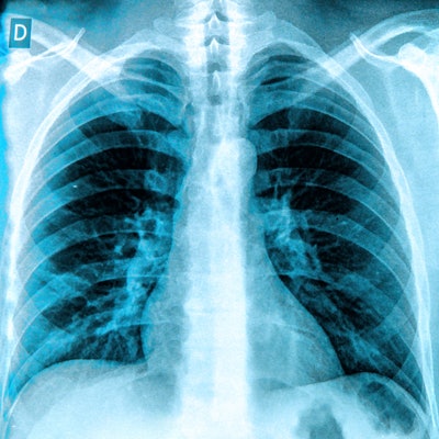 2017 12 01 19 30 7318 X Ray Chest Lungs 400b