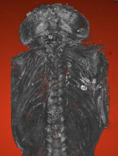 Micro-CT scan of the male fetus. Image courtesy of Maidstone Museum and Nikon Metrology.