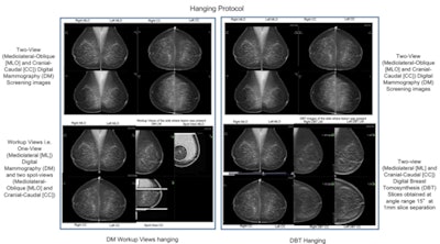 2018 06 12 17 39 1937 2018 06 12 Hanging Protocol 500
