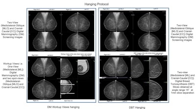 2018 06 12 17 39 2094 2018 06 12 Hanging Protocol 800