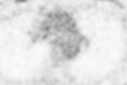 2018 06 15 18 37 6758 2018 06 18 Figure Pet Mri Thumb