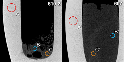 Hounsfield unit (HU) measurements: Analogous placement of regions of interest A and A' (calcite mineral), B and B' (surrounding material), C and C' (radiopaque structures) for two canopic jars (inventory numbers 610-2 and 607, respectively) on sagittal multiplanar CT scan reconstructions (slab thickness 1.5 mm). All images courtesy of Dr. Patrick Eppenberger.
