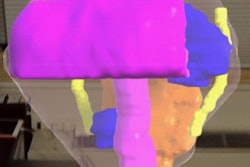 2018 06 26 18 02 0868 2018 06 26 Ar Prostate 20180626180126