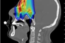 2018 07 03 22 01 9126 Jd Proton Pe Tx Fig5 Thumb