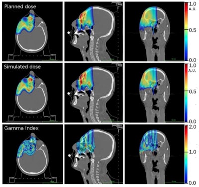 Comparison of prescribed dose distributions calculated by the treatment planning system with dose predicted by the INSIDE Monte Carlo tool. (Courtesy: E Fiorina et al, Physica Medica, 10.1016/j.ejmp.2018.05.002, ©2018, Associazione Italiana di Fisica Medica)