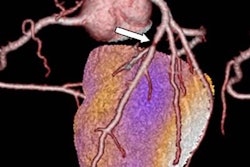 2018 07 05 16 21 7007 2018 07 03 16 22 0383 Cardiac Hybrid Image 20180703164402