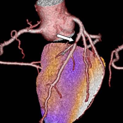 2018 07 05 16 21 7007 2018 07 03 16 22 0383 Cardiac Hybrid Image 20180703164402