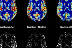 2018 07 06 17 58 6709 2018 07 05 17 31 7148 Necktie Mri 20180705174812