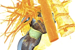 2018 07 12 18 00 9899 2018 07 13 3 D Heart Model 20180712184245