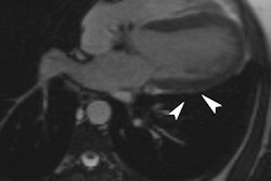 2018 07 16 23 05 1231 2018 07 17 Cardiac Thumb