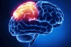 2018 07 24 22 17 0515 Brain 400