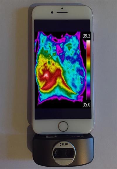 Thermal images recorded on a smartphone with thermal camera attachments. Image courtesy of Israel Gannot.