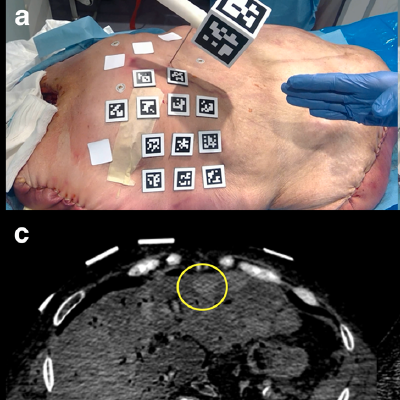 2018 07 31 15 43 7947 2018 07 31 Augmented Reality Interventional 20180731155318