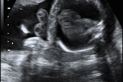 2018 07 05 23 14 6630 10115782 20170117210037 0 20170117210343