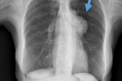 2018 08 09 20 38 2484 2018 08 10 Chest Xray Thumb
