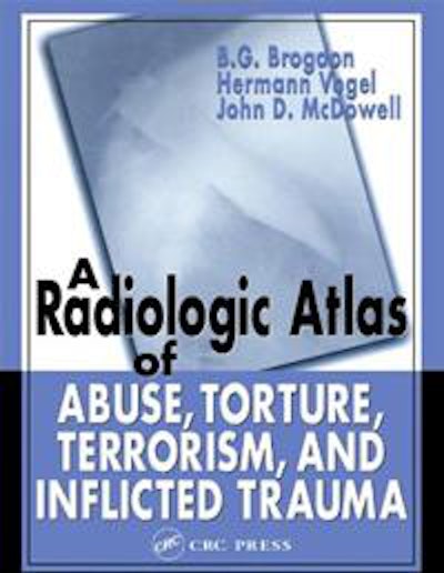 The book Vogel wrote with B.G. Brogdon and John McDowell.