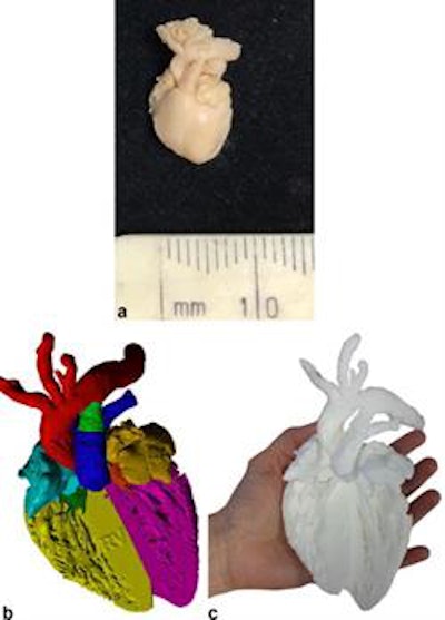 A 3D printing from micro-CT of an archival 16 week gestation fetal heart for educational purposes. (a) External appearances of the fetal heart, measuring under 1 cm in length, (b) virtual 3D volume rendered micro-CT imaged model with cardiac segments color-coded and (c) final 3D-printed model, resized to 10 x 10 x 10 original dimensions for use as an educational tool. All images courtesy of BJR.
