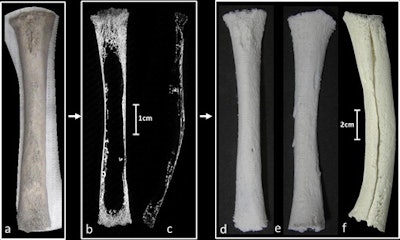 Imaging to 3D printing of a neonatal right tibia from “Parrot’s bone” collection. (a) One-half of an original bone specimen, cut by the 19th century French doctor in a longitudinal section and subsequently mounted onto polystyrene, with cut surface facing the mounted material. (b) Micro-CT image of the same specimen in both longitudinal 2.5 mm thick slab view and (c) nonmanipulated micro-CT sagittal plane. The bone was extremely porous and also bowed in the sagittal section making handling particularly challenging. (d) A 3D-printed version of the bone specimen twice life size and (e) the subsequently matched longitudinal “half section” within the collection. This was only possible by 3D printing the entire collection and physically matching the components together by trabecular pattern, size and pathology as shown in (f).