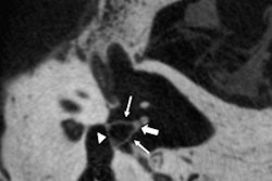 2018 08 13 19 20 3762 2018 08 14 Fpct Thumb