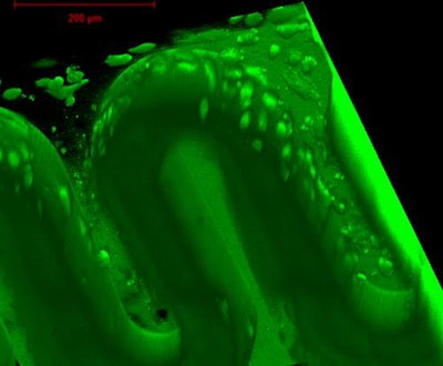 Tiny 3D-printed structures made of biocompatible materials. Image courtesy of Technische Universität Wien.