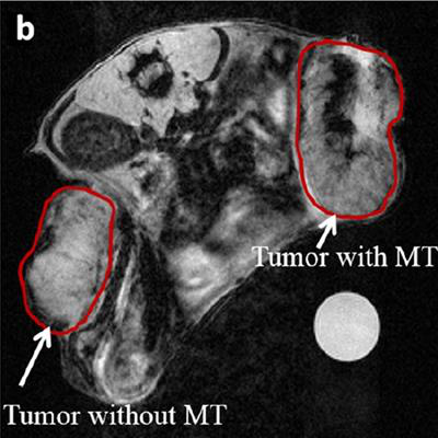 2018 08 17 18 27 4279 2018 08 20 Med Phys Lc Magnetic Targeting (1) 20180817182650