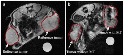 In vivo MR images of tumors before (a) and after (b) injection of ultramagnetic liposomes, with and without magnetic targeting. Image courtesy of C J Thébault et al, Mol. Imaging Biol. 10.1007/s11307-018-1238-3.