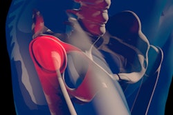 2018 08 20 20 01 9507 Thigh Femoral Head 400