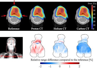Simulated proton-CT, helium-CT, and carbon-CT images. Image courtesy of Sebastian Meyer.