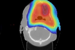 2018 08 29 18 36 8713 2018 08 30 Aapm Ion Ct Thumb