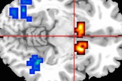 2018 08 29 21 29 2127 Jama Cannaibis Mri 275