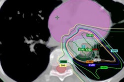 2018 09 07 15 53 6002 Pet Ct Ame Mol Insider 20180907150630