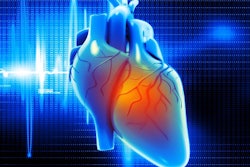 2018 08 27 23 46 8725 Heart Ekg 400