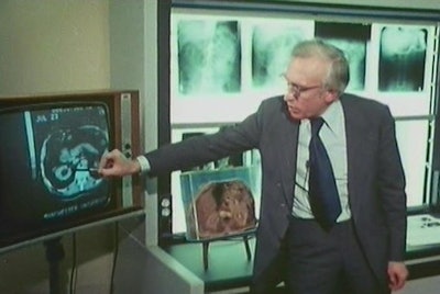 In the late 1970s, Isherwood demonstrates an image from the EMI 5005 machine installed at Manchester University. He shows how the kidney can be seen as clearly on the CT scan as it could on the sliced specimen alongside. Image courtesy of Liz Beckmann.