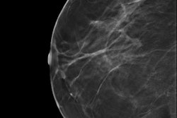 2018 09 13 20 41 9235 2018 09 14 Norway Dbt Thumb