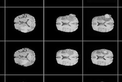 2018 09 14 23 01 7405 Nvidia Ai Mri 20180914234334