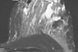 2018 10 01 22 00 9451 2018 10 02 Lactating Breast Image 20181001223500