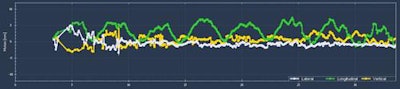 A typical trace shows the motion of a patient's airway. Image courtesy of Wilko Verbakel.
