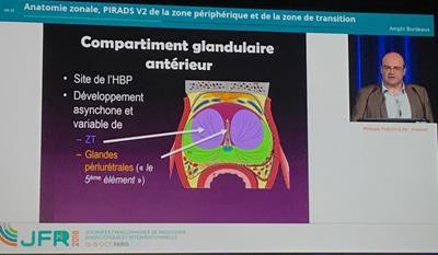 Dr. Philippe Puech speaks at JFR 2018.
