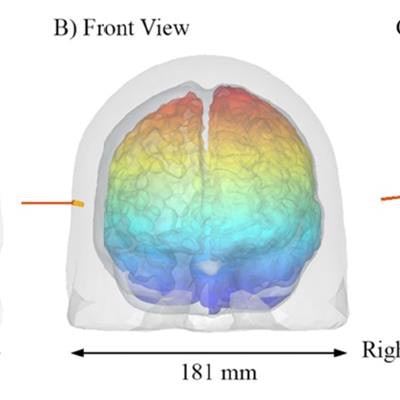 2018 10 18 18 04 6600 2018 10 19 Tr Nir Fig4 20181018183136