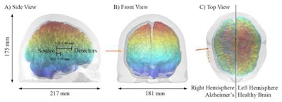 Modeling the potential of tr-NIR imaging to visualize brain atrophy progression. Images courtesy of Biomed. Opt. Express 9 4094, OSA.