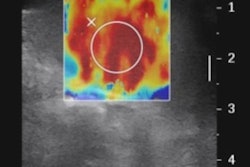 2018 10 19 18 40 8162 2018 10 22 Pediatric Liver Thumb