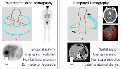 PET/CT has excelled in oncology for whole-body staging. All images courtesy of Thomas Beyer, PhD.