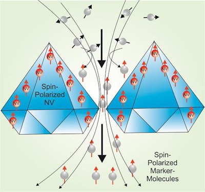 The technique used by the researchers is based on the hyperpolarization of marker molecules like pyruvate used for MRI (NV = nitrogen vacancies). Image courtesy of MetaboliQs.