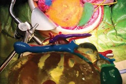 2018 11 14 23 43 7071 2018 11 15 3 D Printed Neuroblastoma 20181114233309