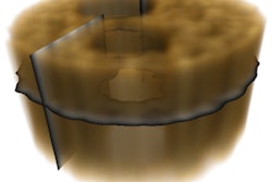 2018 11 30 18 20 5864 2018 11 30 Ghost Tomography 400