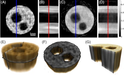 Horizontal (A) and vertical (B) 2D slices through the 3D x-ray GT reconstructed volume with a voxel pitch of 48 µm. The corresponding horizontal (C) and vertical (D) 2D slices through the conventional 3D tomography reconstructed volume obtained from the same set of experiments. (E) A semitransparent rendering of the 3D GT reconstructed object indicating the location of the slices (A) and (B). Horizontal (F) and vertical (G) cutaway images of the rendered ghost-tomogram volume showing the position of slices (A) and (B), respectively. Note that the blue lines in (A) and (C) indicate the position of the orthogonal slices (B) and (D); likewise, the red lines in (B) and (D) indicate the location of perpendicular slices (A) and (C). Image courtesy of Andrew Kingston et al, 'Ghost tomgography, Optica, November 2018, Vol. 5:12, pp. 1516-1520.