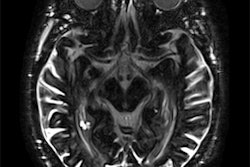 2018 12 05 17 41 4769 2018 12 04 Mri Gbca2 Thumb