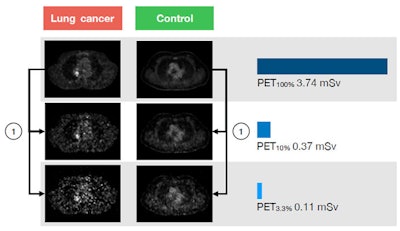 1: Low-dose reconstructions generated by unlisting the list-mode data. All images courtesy of Dr. Michael Messerli et al.